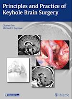 Principles and Practice of Keyhole Brain Surgery