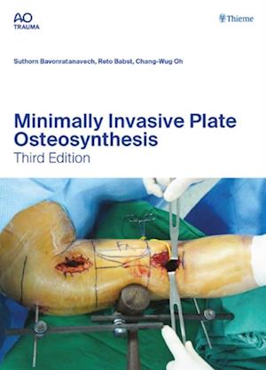 Minimally Invasive Plate Osteosynthesis