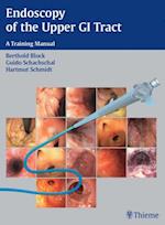 Endoscopy of the Upper GI Tract