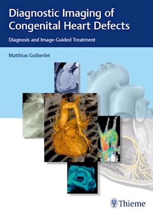 Diagnostic Imaging of Congenital Heart Defects