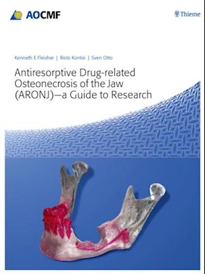 Antiresorptive Drug-Related Osteonecrosis of the Jaw (ARONJ) - A Guide to Research