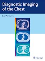 Diagnostic Imaging of the Chest