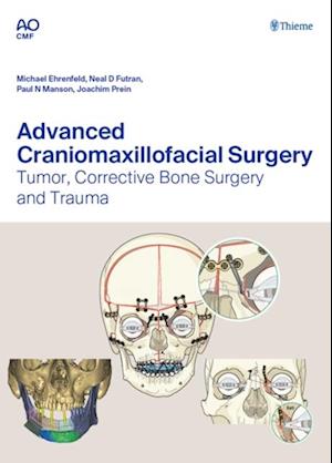 Advanced Craniomaxillofacial Surgery