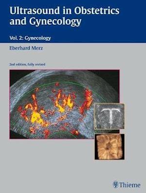 Ultrasound in Obstetrics and Gynecology : Volume 2: Gynecology