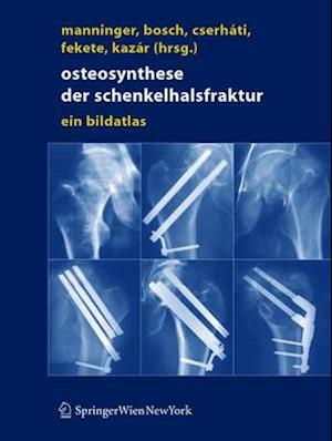 Osteosynthese der Schenkelhalsfraktur