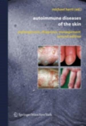 Autoimmune Diseases of the Skin