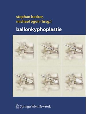 Ballonkyphoplastie