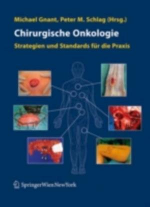 Chirurgische Onkologie