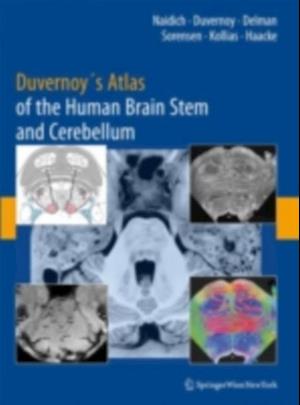 Duvernoy's Atlas of the Human Brain Stem and Cerebellum