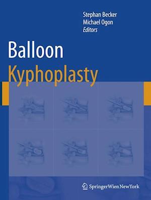 Balloon Kyphoplasty