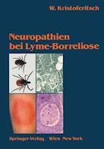 Neuropathien bei Lyme-Borreliose