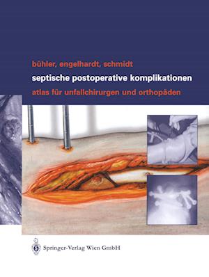 Septische postoperative Komplikationen