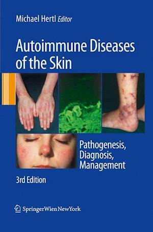 Autoimmune Diseases of the Skin