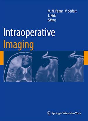 Intraoperative Imaging