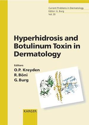 Hyperhidrosis and Botulinum Toxin in Dermatology