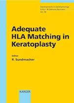 Adequate HLA Matching in Keratoplasty