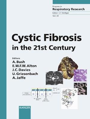 Cystic Fibrosis in the 21st Century