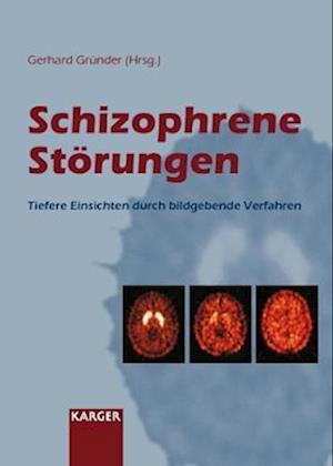 Schizophrene Storungen