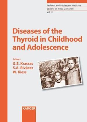 Diseases of the Thyroid in Childhood and Adolescence