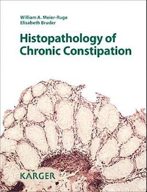 Histopathology of Chronic Constipation