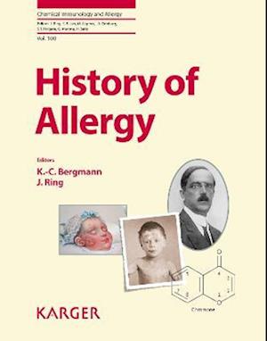 History of Allergy