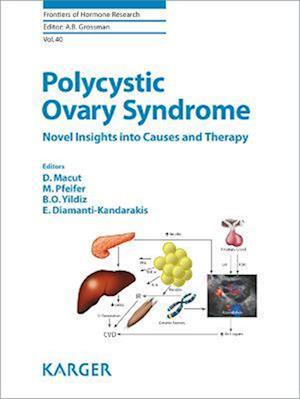 Polycystic Ovary Syndrome