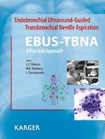 Endobronchial Ultrasound-Guided Transbronchial Needle Aspiration (EBUS-TBNA): A Practical Approach