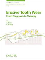 Erosive Tooth Wear