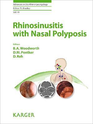 Rhinosinusitis with Nasal Polyposis