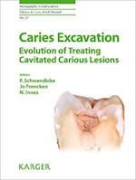 Caries Excavation: Evolution of Treating Cavitated Carious Lesions