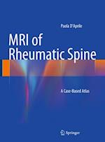 MRI of Rheumatic Spine