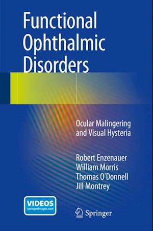 Functional Ophthalmic Disorders