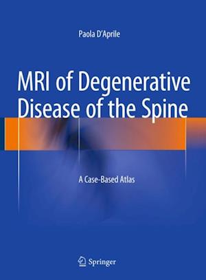 MRI of Degenerative Disease of the Spine