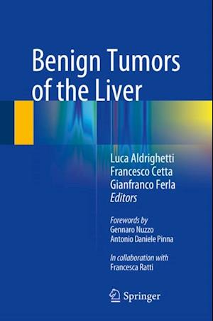 Benign Tumors of the Liver