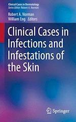 Clinical Cases in Infections and Infestations of the Skin