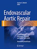 Endovascular Aortic Repair