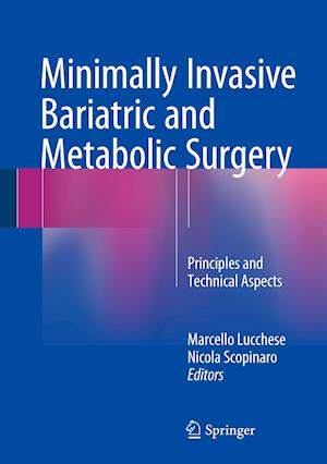 Minimally Invasive Bariatric and Metabolic Surgery
