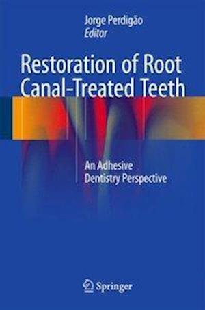 Restoration of Root Canal-Treated Teeth