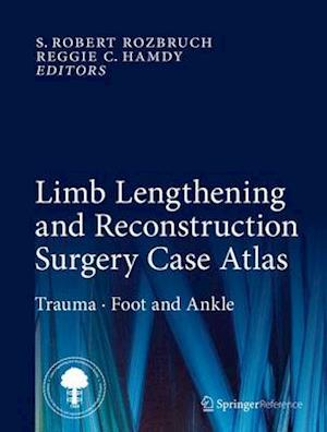 Limb Lengthening and Reconstruction Surgery Case Atlas