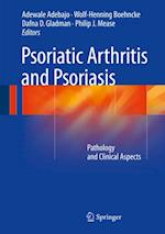 Psoriatic Arthritis and Psoriasis