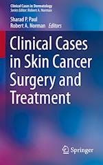 Clinical Cases in Skin Cancer Surgery and Treatment