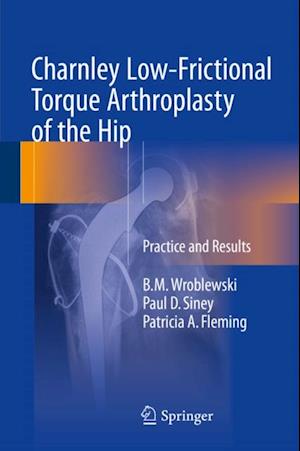 Charnley Low-Frictional Torque Arthroplasty of the Hip