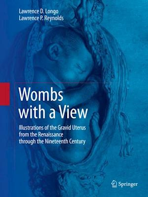 Wombs with a View