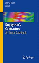 Dupuytren's Contracture