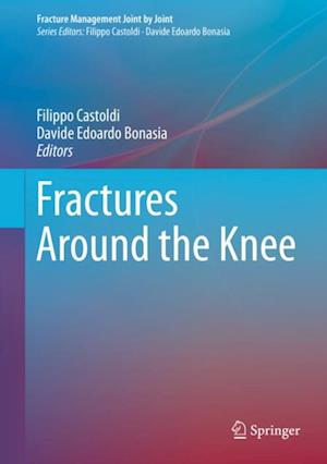 Fractures Around the Knee