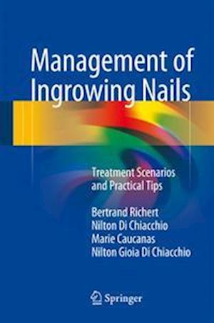 Management of Ingrowing Nails