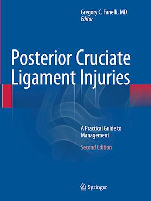 Posterior Cruciate Ligament Injuries