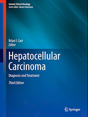 Hepatocellular Carcinoma