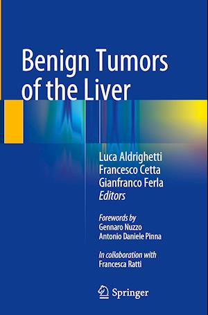 Benign Tumors of the Liver