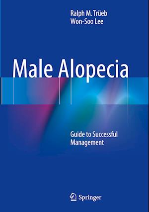 Male Alopecia